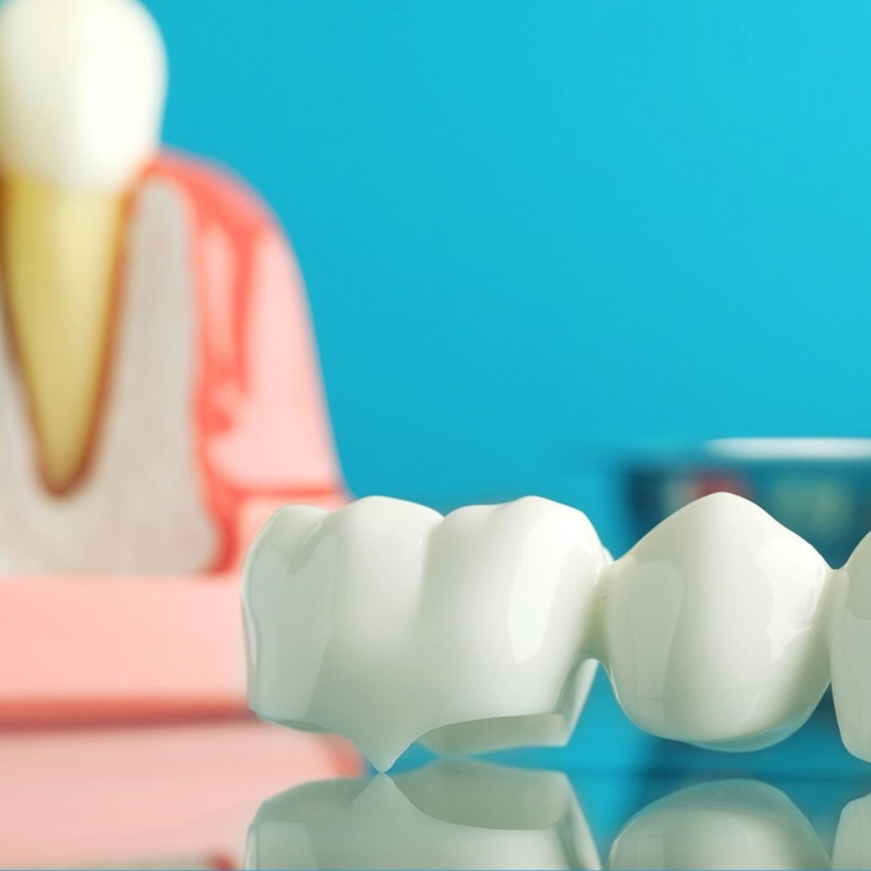 Coronas de porcelanas